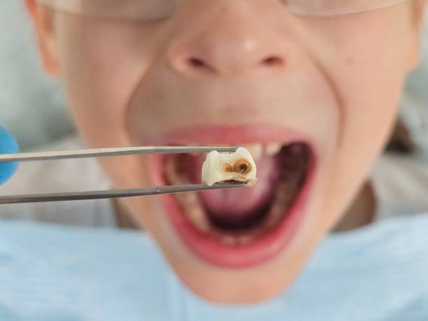 Best Urgent Dental Care for Toothache in National Harbor, MD